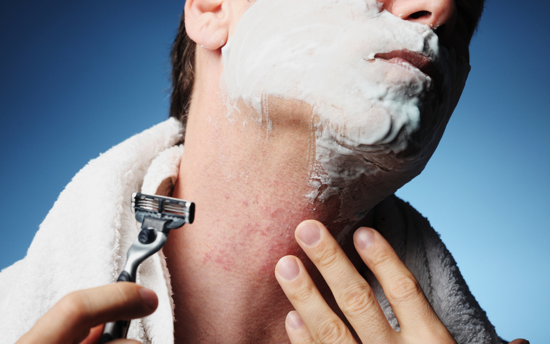 The #1 Mistake Men Make That Causes Razor Burn